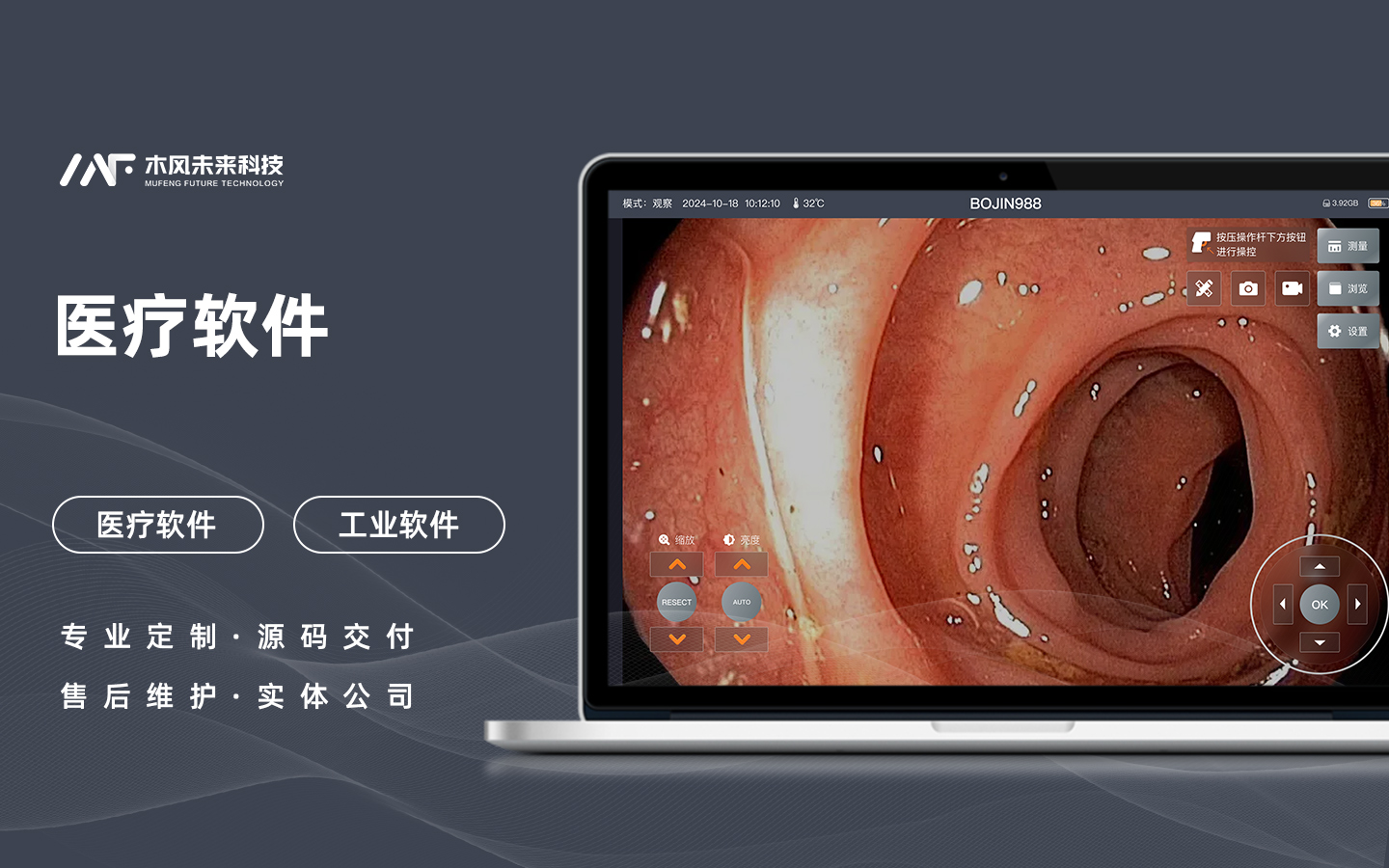 内窥镜系统